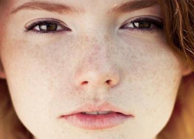 ماسک لک صورت برای درمان لک و تیرگی پوست