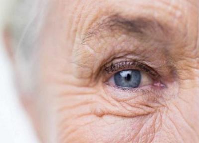 6 مشکل چشم در سنین بالا؛ نحوه تشخیص و درمان